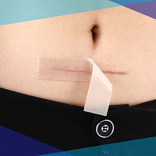 2 Rolls Soft Silicone Tape Easy Tear Gel Tape 1.5 Inch x 1.6 Yard, 1 Inch x 1...