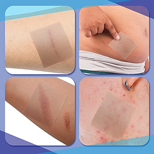 2 Rolls Soft Silicone Tape Silicone Gel Tape Skin Self-Adhesive Bandage Tape ...