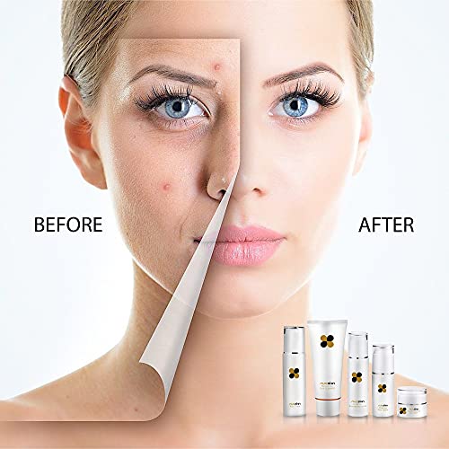 Nuaskin 5-Piece Skin Care Set with Facial Cleanser Toner Lotion Cream - Self ...