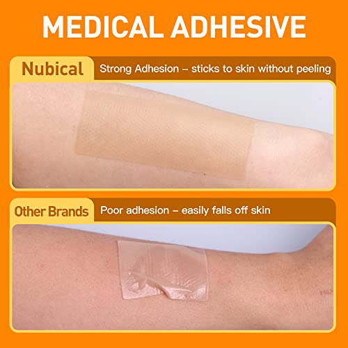 Silicone Scar Sheets (1.6” X 120”), Medical Silicone Scar Tape Roll, Strips, ...
