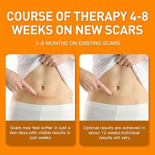 Silicone Scar Sheets (1.6” X 120”), Medical Silicone Scar Tape Roll, Strips, ...