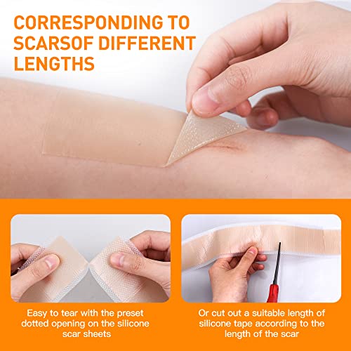 Silicone Scar Sheets (1.6” X 120”), Medical Silicone Scar Tape Roll, Strips, ...