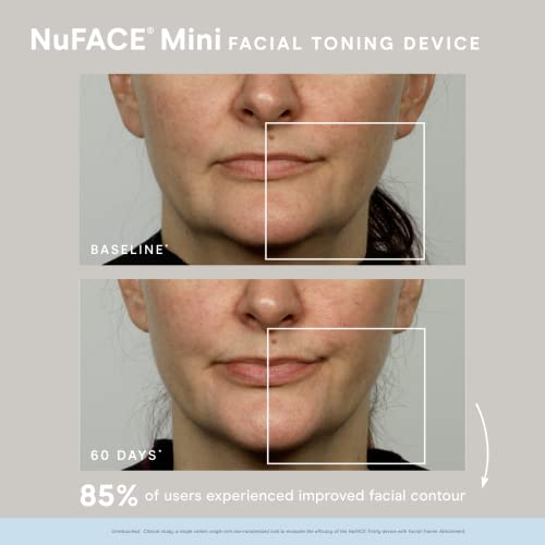 NuFACE MINI Starter Kit