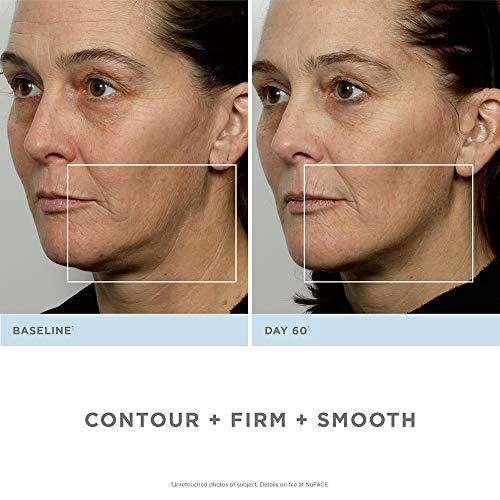 NuFACE Trinity Starter Kit - Facial Toning Device