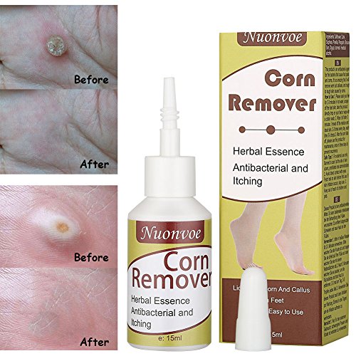 Corn Remover, Corn Removal, Corn Remover Liquid, Foot Corn Removal, Corn Call...