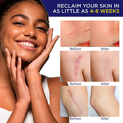 Advanced Silicone Scar Sheets Medical Grade Silicone Gel Tape Roll for Scar R...