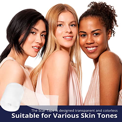 Advanced Silicone Scar Sheets Medical Grade Silicone Gel Tape Roll for Scar R...