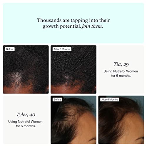 Nutrafol Women's Hair Growth Supplement, Clinically Proven for Thicker-Lookin...