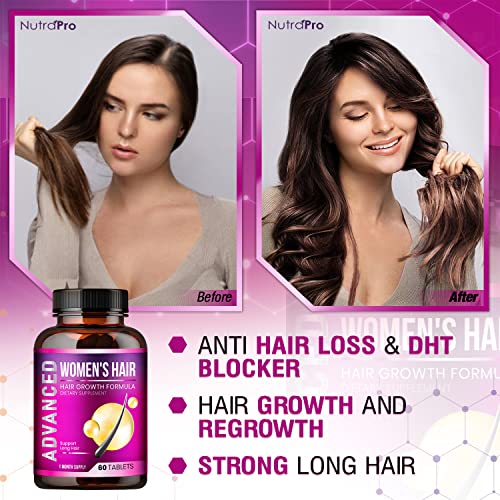 Hair Growth Vitamins For Women - Hair Vitamins For Hair Loss For Women .Regro...