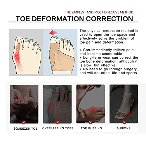 Toe Separator ,hammer toe corrector for women , Toe spacers for feet Gel Toe ...