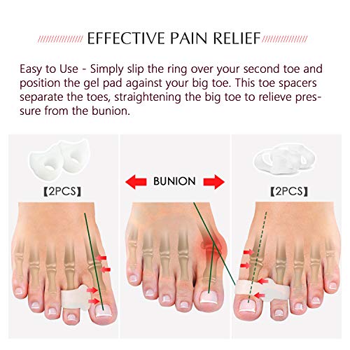 Toe Separator ,hammer toe corrector for women , Toe spacers for feet Gel Toe ...
