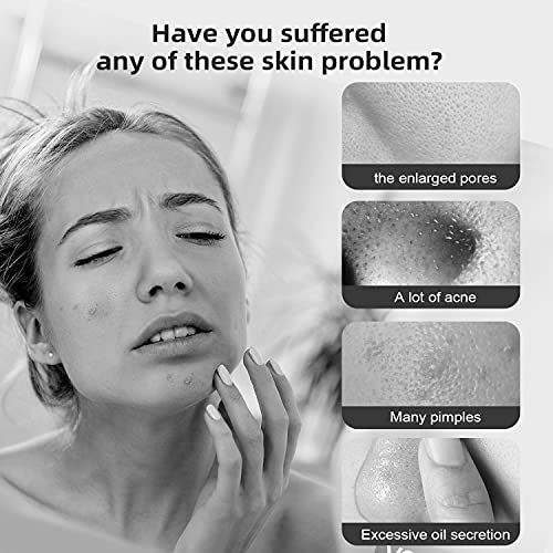 Oiiwak Blackhead Remover Pore Vacuum with Camera Visual Facial Blackhead Pimp...