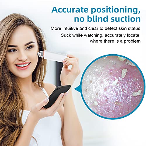 Oiiwak Blackhead Remover Pore Vacuum with Camera Visual Facial Blackhead Pimp...
