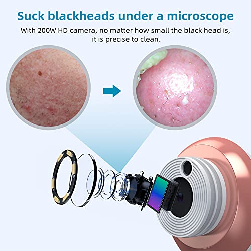 Oiiwak Blackhead Remover Pore Vacuum with Camera Visual Facial Blackhead Pimp...