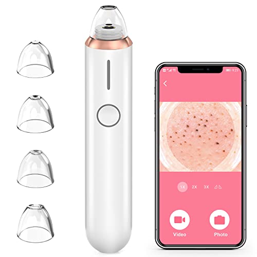 Oiiwak Blackhead Remover Pore Vacuum with Camera Visual Facial Blackhead Pimp...