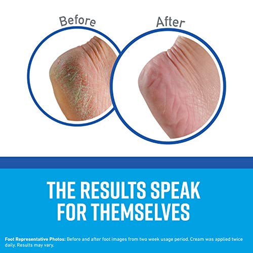 O'Keeffe's Healthy Feet Foot Cream for Extremely Dry, Cracked Feet, 3.2 Ounce...