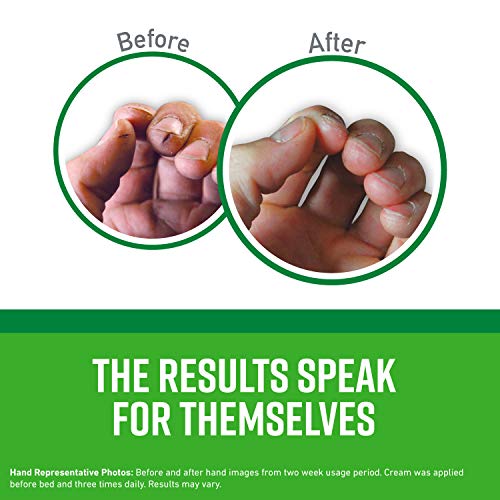 O'Keeffe's Working Hands Hand Cream for Extremely Dry, Cracked Hands, 3.4 Oun...