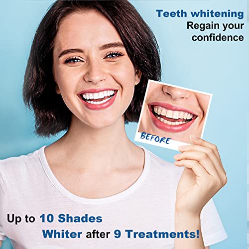 Teeth-Whitening-Kit-OLLM Tooth Whitener with 2 Tray - Professional Oral Beaut...
