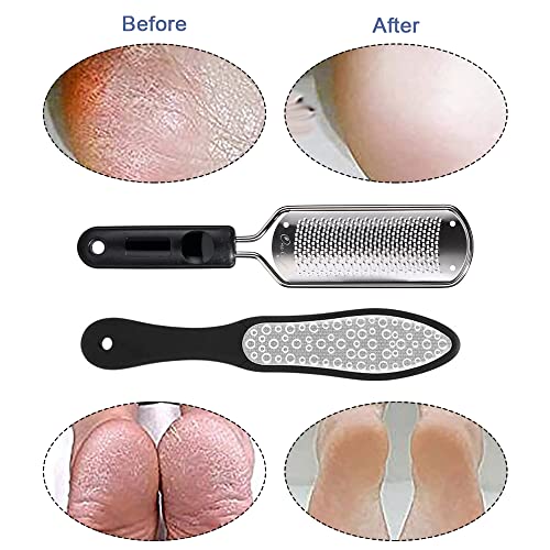 Oneleaf 2PCS Professional Pedicure Rasp Foot File Cracked Skin Corns Callus R...
