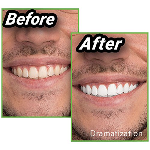 New! As Seen On TV Miracle Teeth Whitener - The Natural Way To Whiten Teeth!