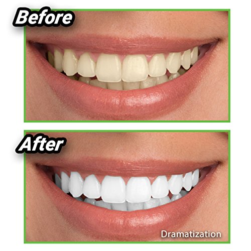ONTEL Miracle Teeth Whitener | Natural Whitening Coconut Charcoal Powder | Ge...