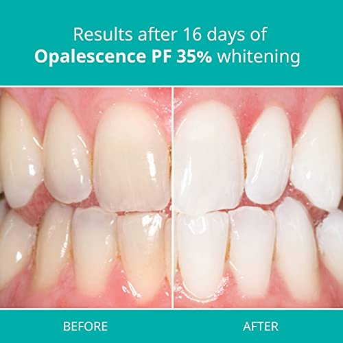 Opalescence at Home Teeth Whitening - Teeth Whitening Gel Syringes - 8 Pack o...