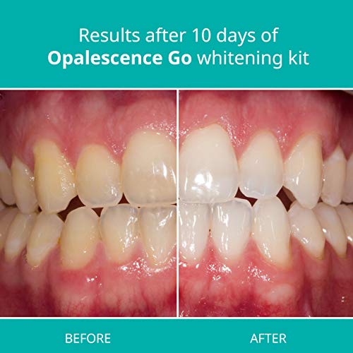 Opalescence Go - Prefilled Teeth Whitening Trays - 10% Hydrogen Peroxide - Mint