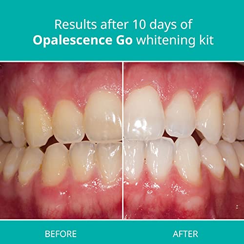 Opalescence Go - Prefilled Teeth Whitening Trays - 15% Hydrogen Peroxide - Mint