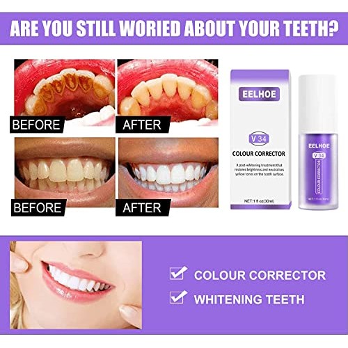 2pcs V34 Color Tooth Correction and Whitening Toothpaste, Suitable for Sensit...