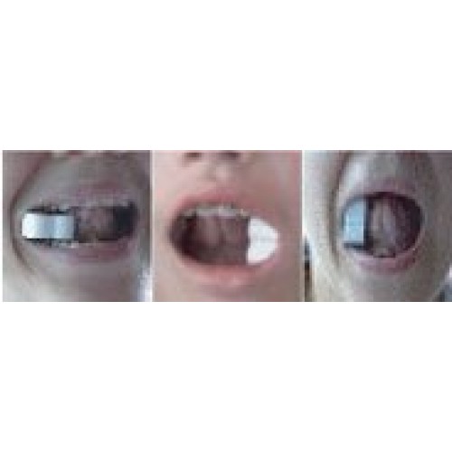 3 Way Mouth Props & Hand Holders