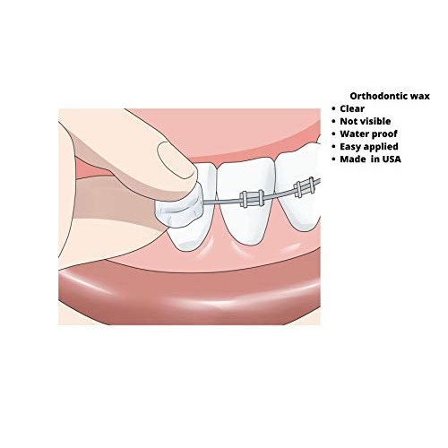 Orthodontic Braces Wax Bundle set for Pain Caused by Braces, Dentures, Dental...