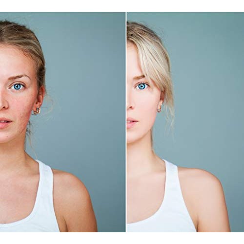 Osmotics Blue Copper 5 Firming Elasticity Repair, This Copper Peptide Anti ag...