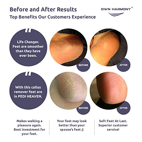 Electric Foot Callus Remover: Own Harmony Professional Foot Care Pedicure Too...