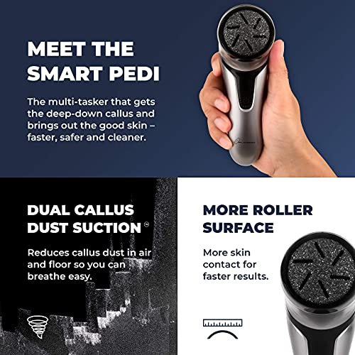 Electric Foot Callus Remover with Vacuum - Own Harmony Professional Pedicure ...