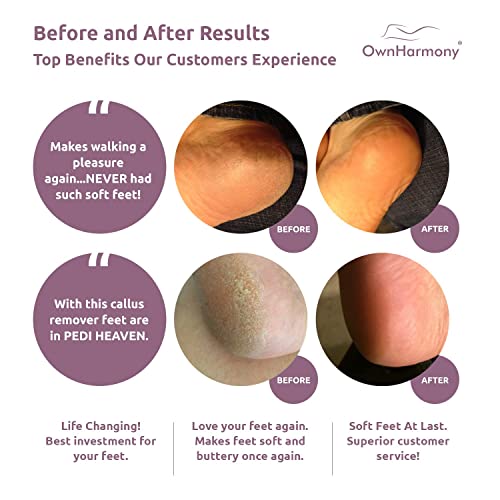 Own Harmony Professional Pedi Foot Care for Women: Rechargeable Pedicure Tool...