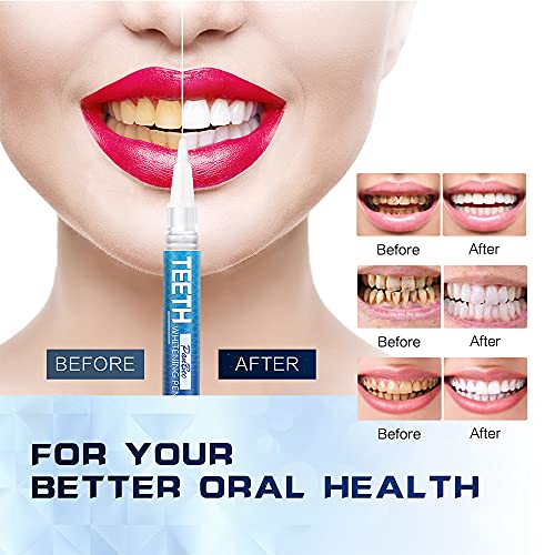 Teeth Whitening Pen- 4 No Sensitivity Pens, 40+ Whitening Treatments, Effecti...