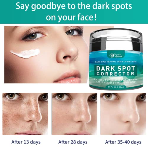Dark Spot Remover for Face, Hyperpigmentation Treatment, Melasma, Freckle, Su...