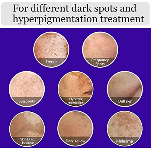 Dark Spot Remover for Face, Hyperpigmentation Treatment, Melasma, Freckle, Su...