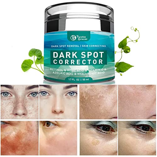 Dark Spot Remover for Face, Hyperpigmentation Treatment, Melasma, Freckle, Su...
