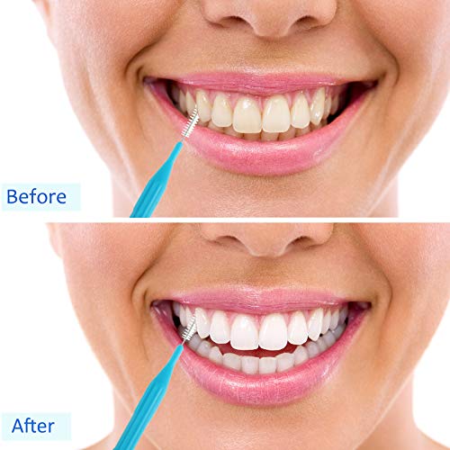 100 Pieces Braces Brush for Cleaner Interdental Brush Toothpick Dental Flossi...