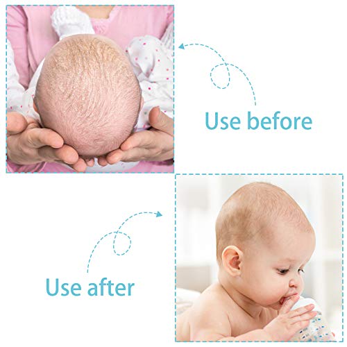 2 Pieces Cradle Cap Brush and Comb, 3-In-1 Design Cradle Cap Brush Safe Baby’...