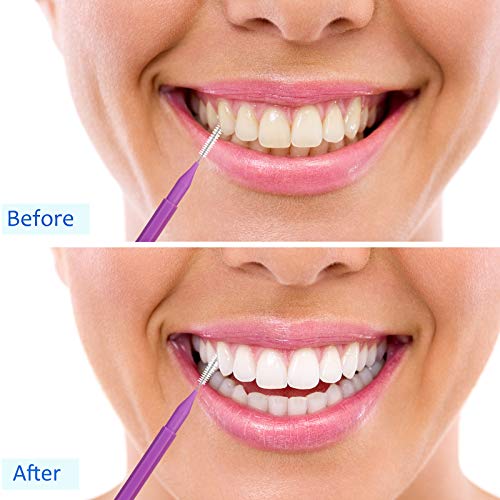 50 Pieces Braces Brush for Cleaner Interdental Brush Toothpick Dental Tooth F...