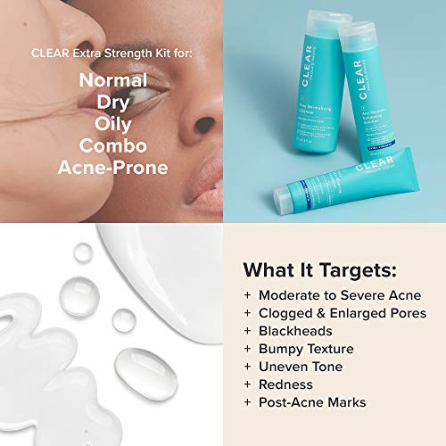 Paula's Choice CLEAR Extra Strength Acne Kit, 2% Salicylic Acid & 5% Benzoyl ...
