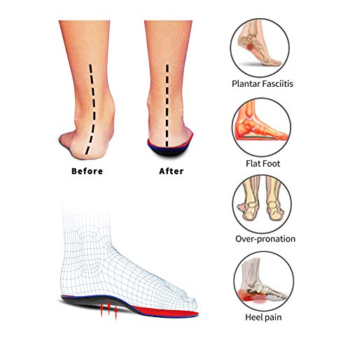 PCSsole Orthotic Arch Support Shoe Inserts Insoles for Flat Feet,Feet Pain,Pl...