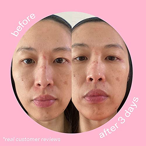 Peach Slices Dark Spot Micro Darts | For Dark Spots, Post-Blemish Redness, & ...