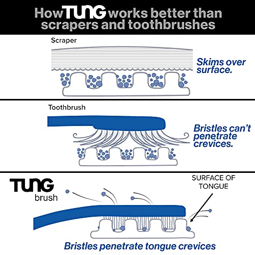 Peak Essentials | The Original Tung Gel | Premium | Tongue Cleaner | Odor Eli...