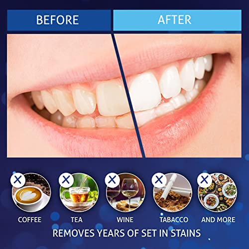 MagicBrite Complete Teeth Whitening Kit at Home Whitener - LED Light, 35% Car...