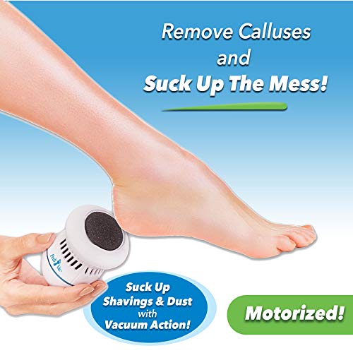 Pedi Vac by Ped Egg - Callus Remover for Feet with Built-in Vacuum Removes De...