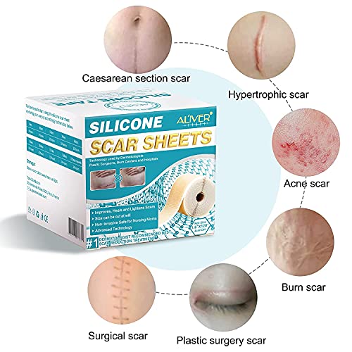Silicone Scar Sheets (1.6 x 120 Inch), Medical Grade Silicone Scar Tape,Scar ...
