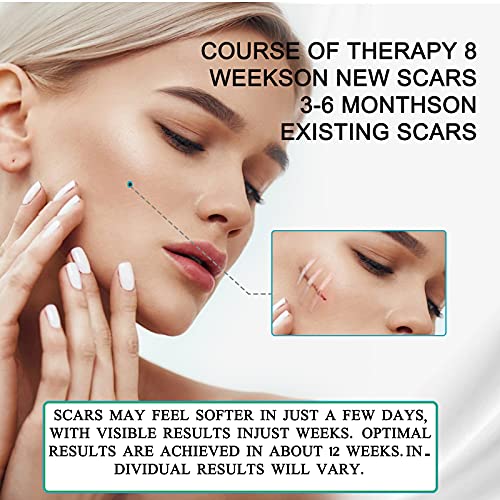 Silicone Scar Sheets (1.6 x 120 Inch), Medical Grade Silicone Scar Tape,Scar ...